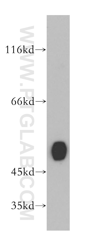 Western Blot (WB) analysis of mouse kidney tissue using GATM Polyclonal antibody (12801-1-AP)