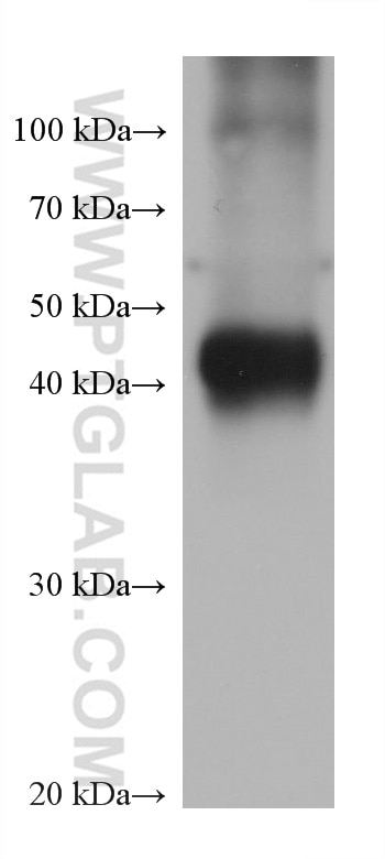 Western Blot (WB) analysis of pig kidney tissue using GATM Monoclonal antibody (68513-1-Ig)