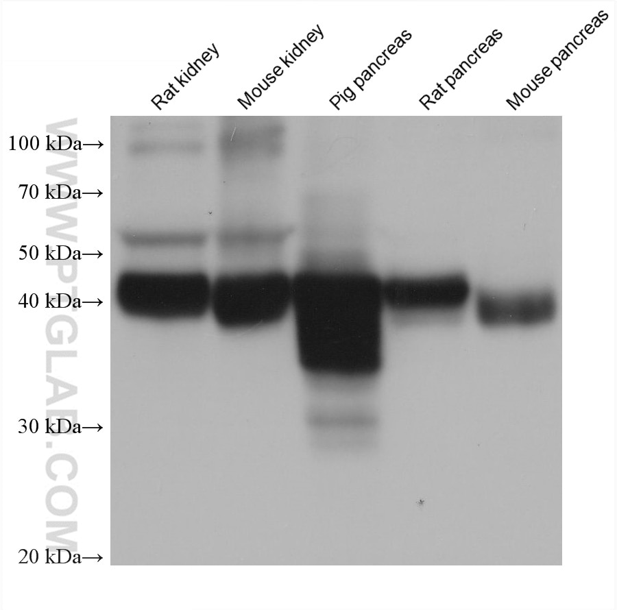 Western Blot (WB) analysis of various lysates using GATM Monoclonal antibody (68513-1-Ig)