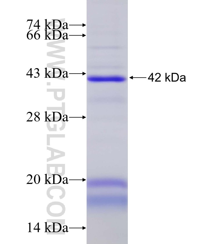 GATM fusion protein Ag3754 SDS-PAGE