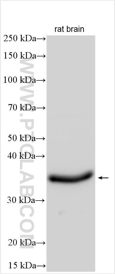 Western Blot (WB) analysis of rat brain tissue using GATSL2 Polyclonal antibody (22843-1-AP)