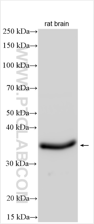 WB analysis of rat brain using 22843-1-AP