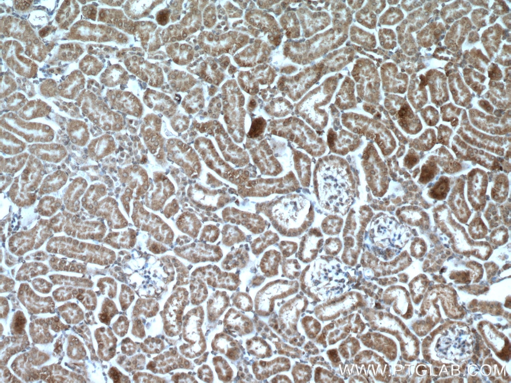 Immunohistochemistry (IHC) staining of mouse kidney tissue using GBA Polyclonal antibody (27972-1-AP)
