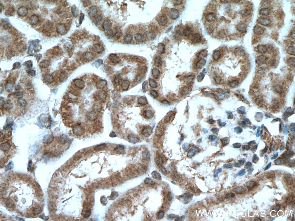 Immunohistochemistry (IHC) staining of mouse kidney tissue using GBA Polyclonal antibody (27972-1-AP)