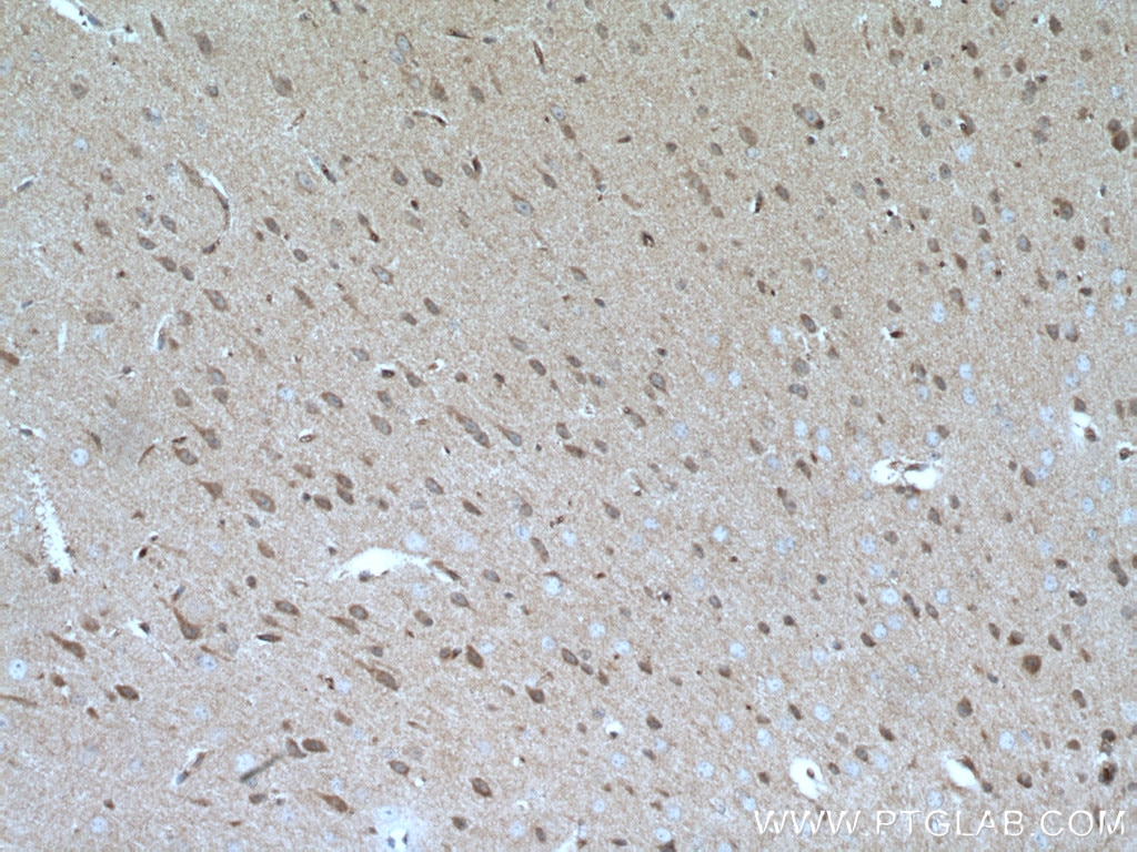 Immunohistochemistry (IHC) staining of mouse brain tissue using GBA Polyclonal antibody (27972-1-AP)