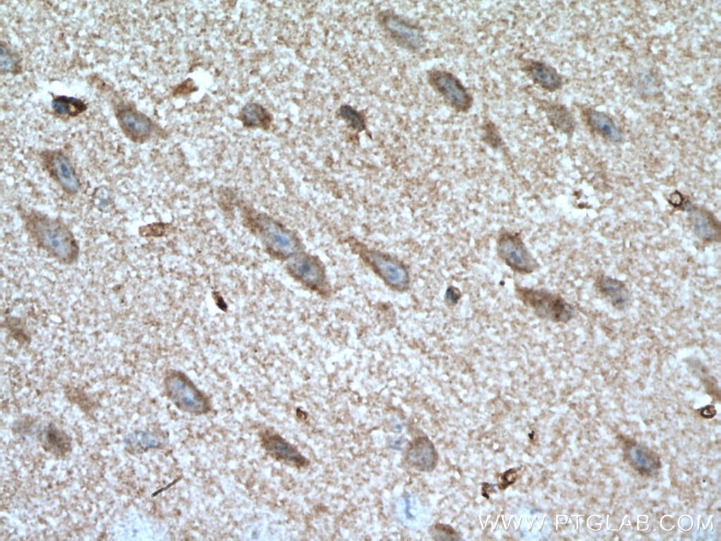 IHC staining of mouse brain using 27972-1-AP