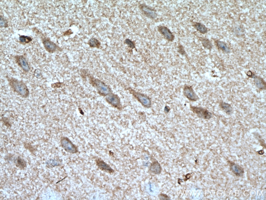 Immunohistochemistry (IHC) staining of mouse brain tissue using GBA Polyclonal antibody (27972-1-AP)