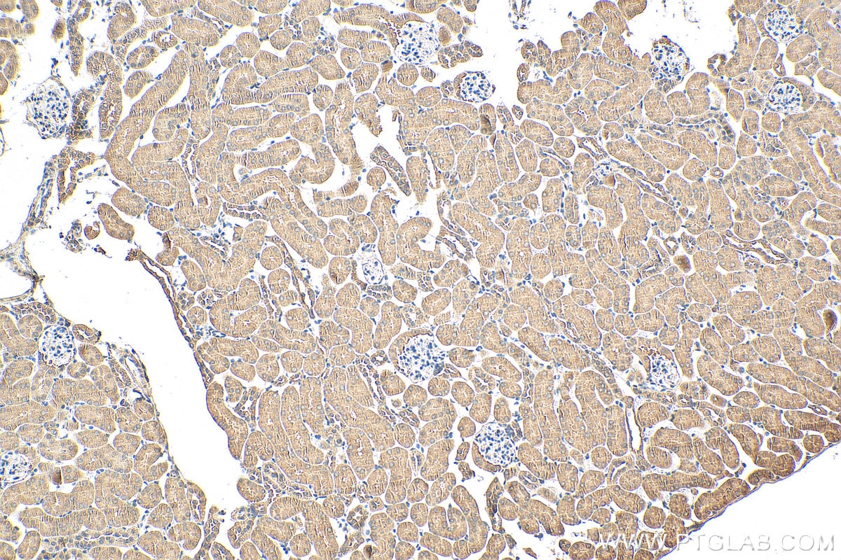 Immunohistochemistry (IHC) staining of mouse kidney tissue using GBA Polyclonal antibody (27972-1-AP)