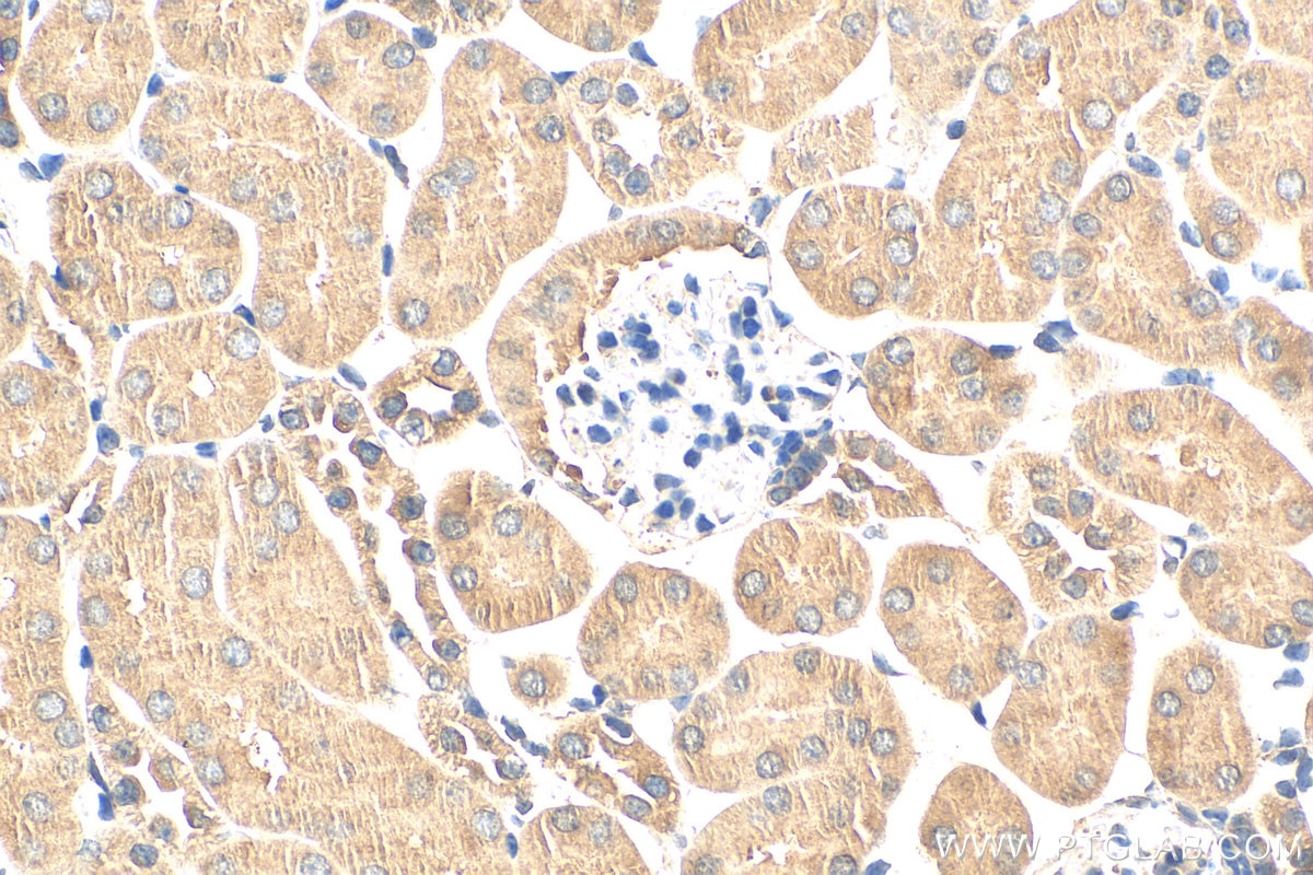 Immunohistochemistry (IHC) staining of mouse kidney tissue using GBA Polyclonal antibody (27972-1-AP)