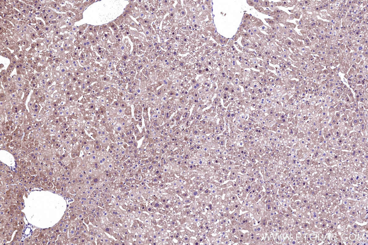 Immunohistochemistry (IHC) staining of mouse liver tissue using GBA Polyclonal antibody (27972-1-AP)