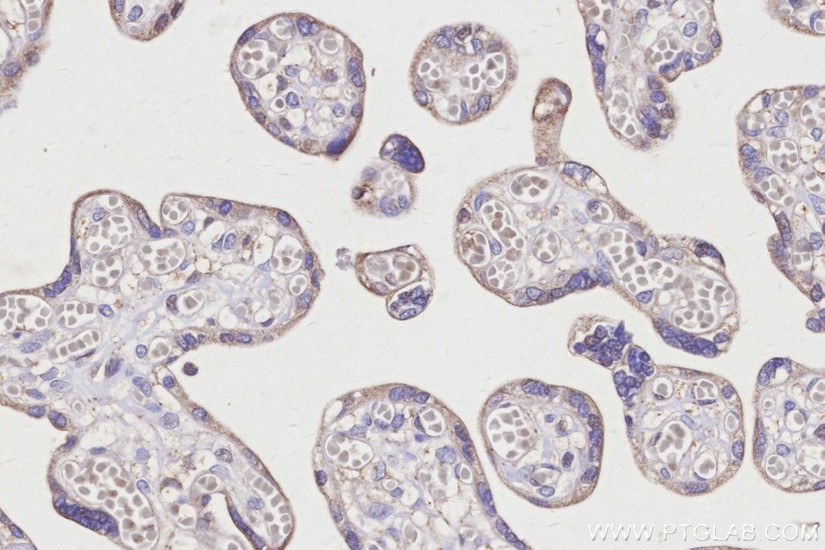 Immunohistochemistry (IHC) staining of human placenta tissue using GBA Polyclonal antibody (27972-1-AP)