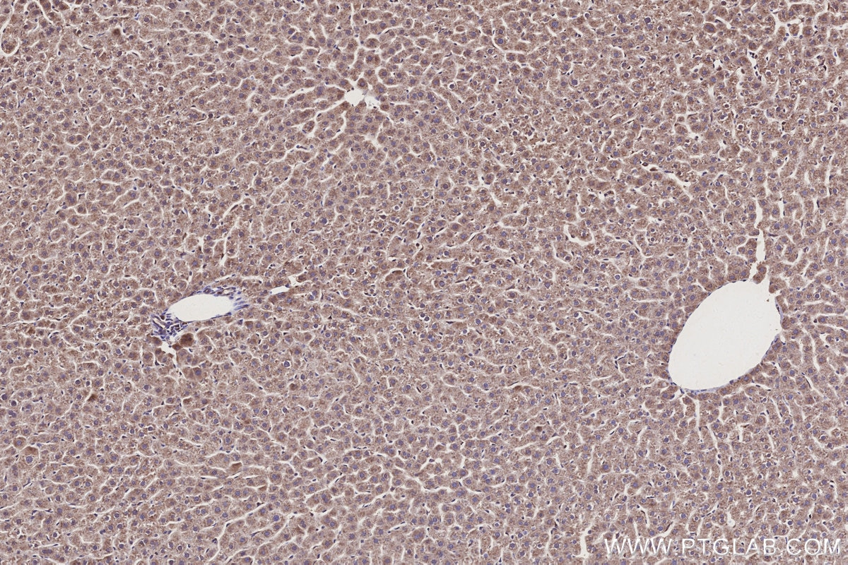 Immunohistochemistry (IHC) staining of rat liver tissue using GBA Polyclonal antibody (27972-1-AP)