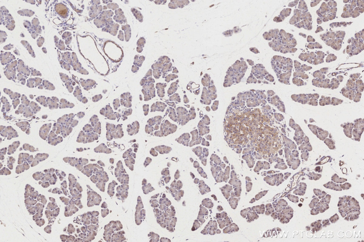 Immunohistochemistry (IHC) staining of rat pancreas tissue using GBA Polyclonal antibody (27972-1-AP)