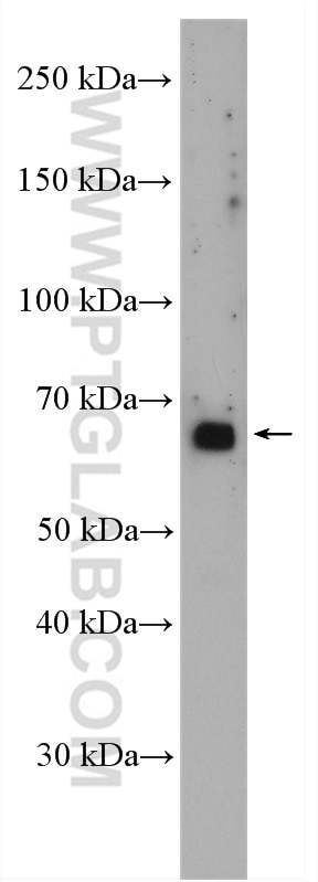Western Blot (WB) analysis of SH-SY5Y cells using GBA Polyclonal antibody (27972-1-AP)