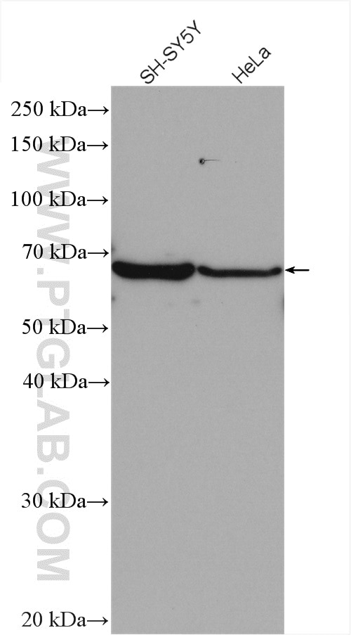 Western Blot (WB) analysis of various lysates using GBA Polyclonal antibody (27972-1-AP)