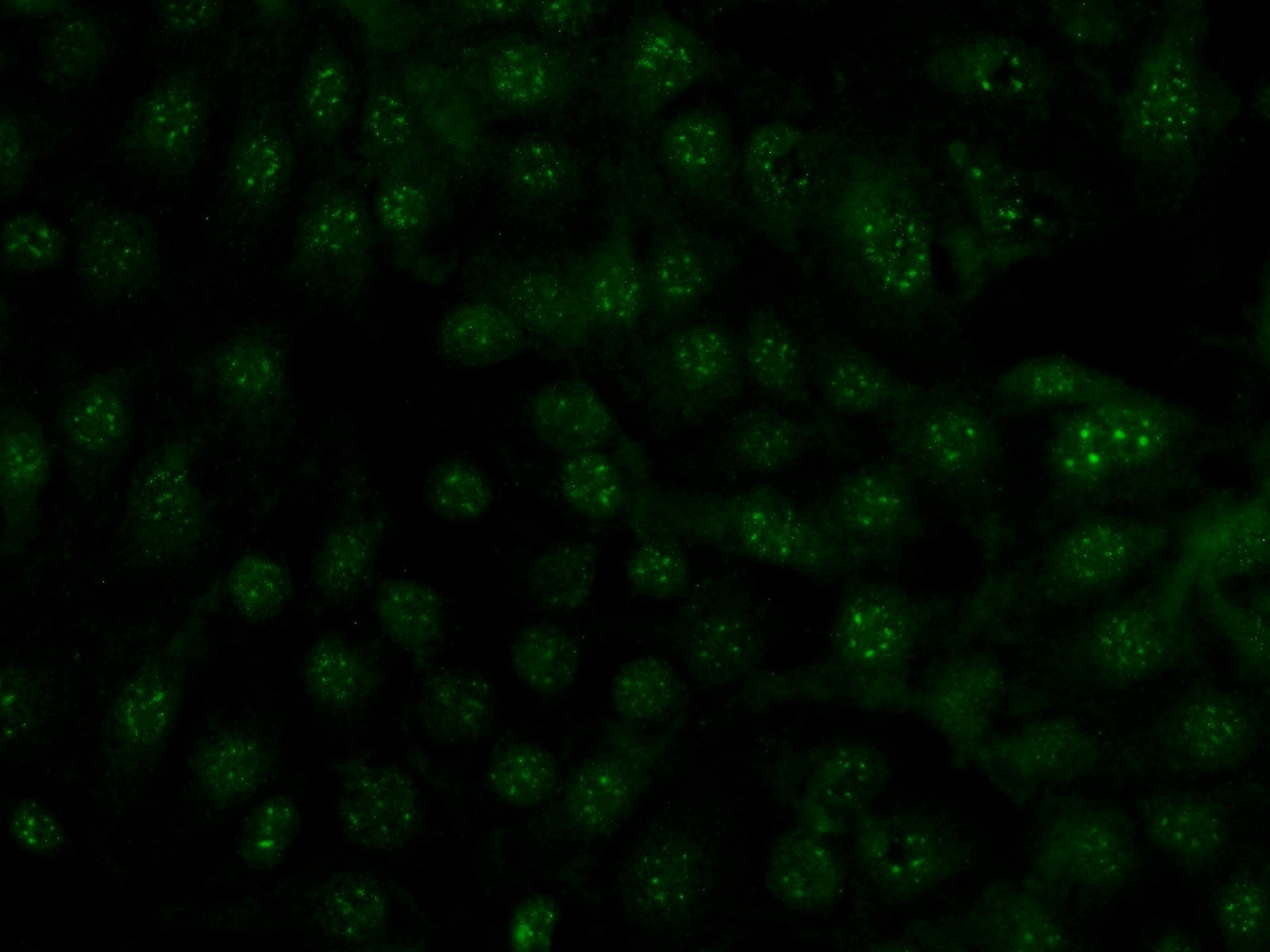 Immunofluorescence (IF) / fluorescent staining of SH-SY5Y cells using GBA Polyclonal antibody (20622-1-AP)