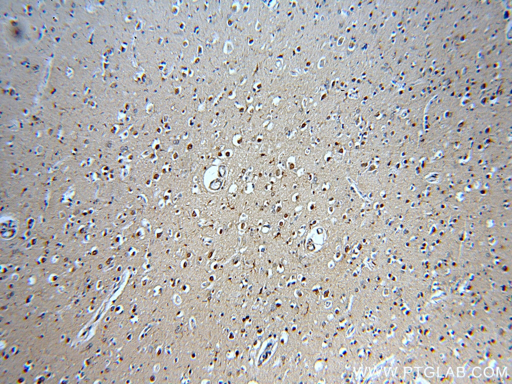 Immunohistochemistry (IHC) staining of human brain tissue using GBA Polyclonal antibody (20622-1-AP)