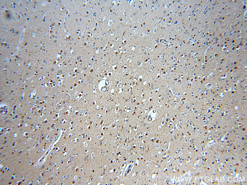 IHC staining of human brain using 20622-1-AP