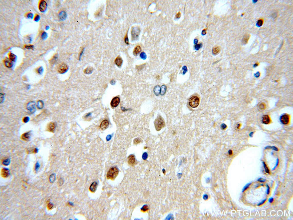 Immunohistochemistry (IHC) staining of human brain tissue using GBA Polyclonal antibody (20622-1-AP)