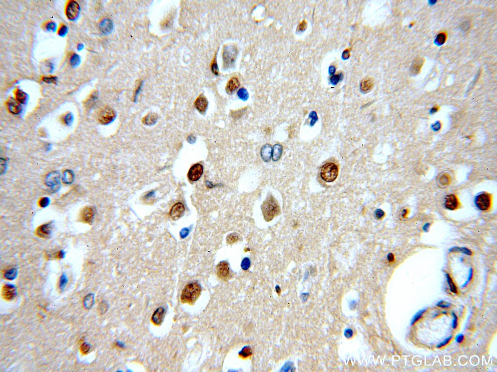 IHC staining of human brain using 20622-1-AP