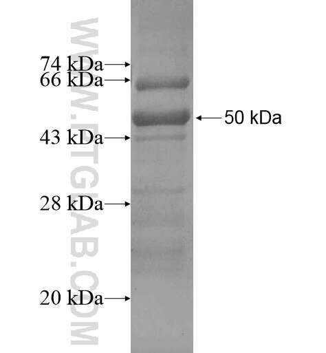 GBA fusion protein Ag13933 SDS-PAGE GBA fusion protein Ag13933 SDS-PAGE