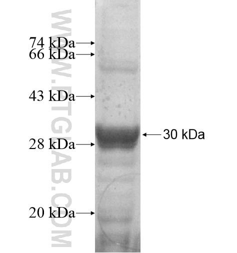 GBA fusion protein Ag13981 SDS-PAGE
