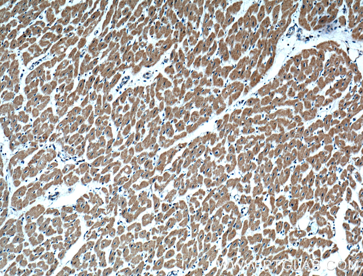 Immunohistochemistry (IHC) staining of human heart tissue using GBAS Polyclonal antibody (18570-1-AP)
