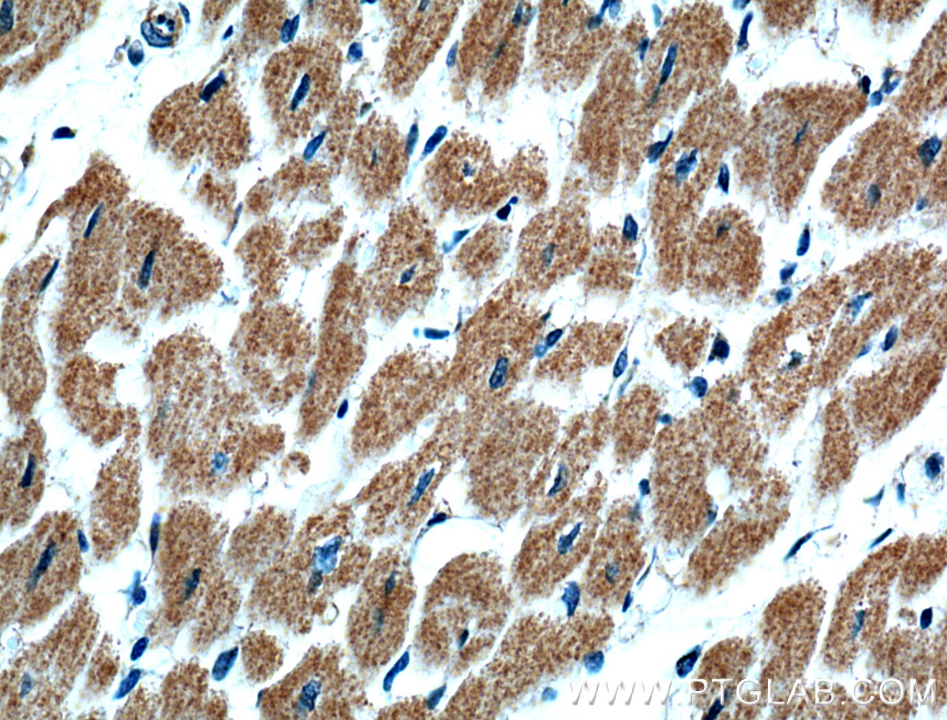 Immunohistochemistry (IHC) staining of human heart tissue using GBAS Polyclonal antibody (18570-1-AP)