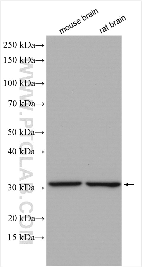 Western Blot (WB) analysis of various lysates using GBAS Polyclonal antibody (18570-1-AP)
