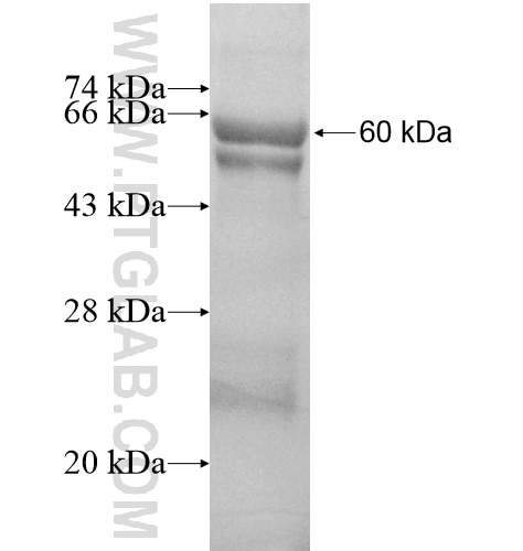 GBAS fusion protein Ag13405 SDS-PAGE