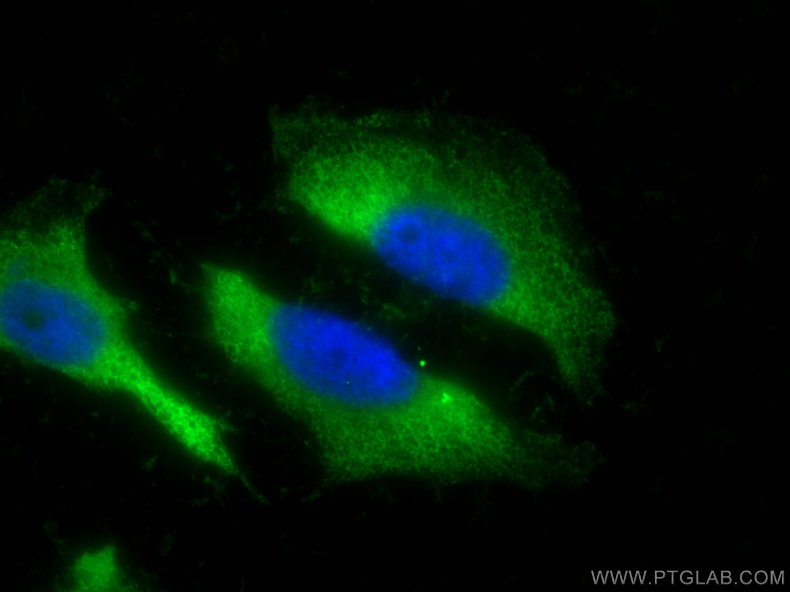 Immunofluorescence (IF) / fluorescent staining of HeLa cells using GBE1 Polyclonal antibody (20313-1-AP)