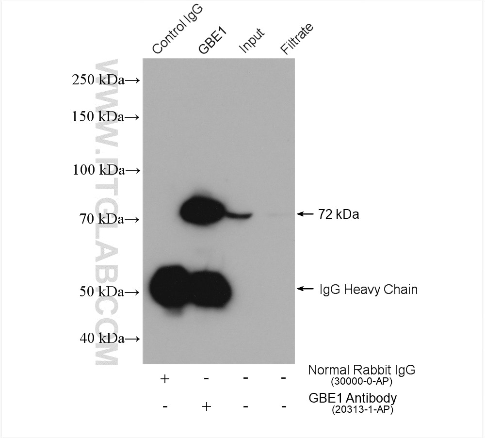 Immunoprecipitation (IP) experiment of L02 cells using GBE1 Polyclonal antibody (20313-1-AP)