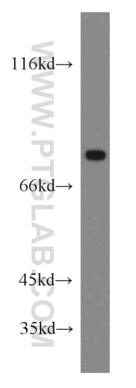 WB analysis of human skeletal muscle using 20313-1-AP