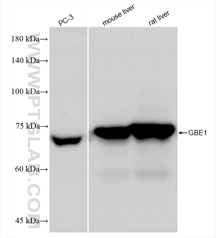Western Blot (WB) analysis of various lysates using GBE1 Recombinant antibody (85143-5-RR)