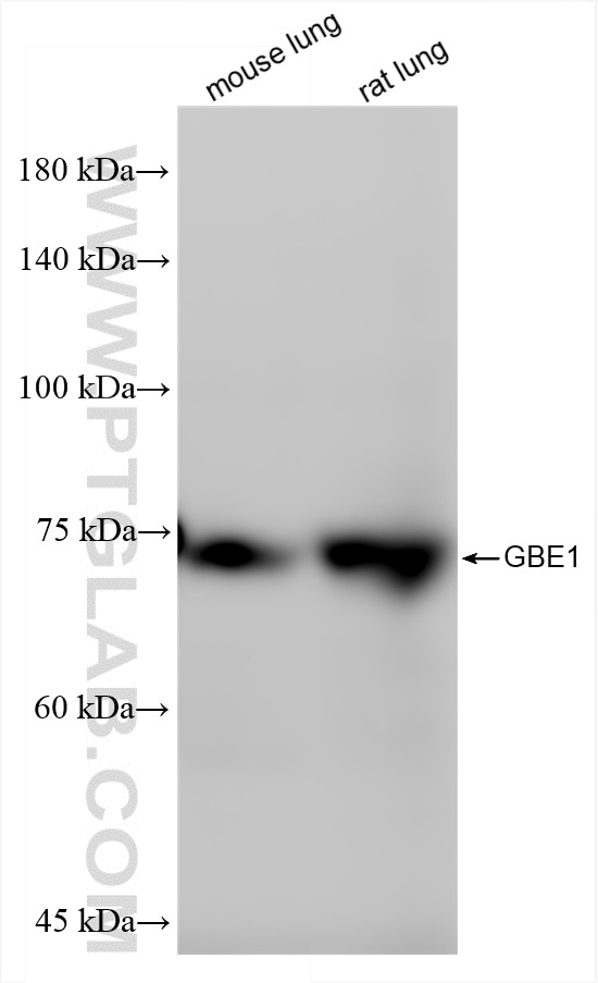 Western Blot (WB) analysis of various lysates using GBE1 Recombinant antibody (85143-5-RR)