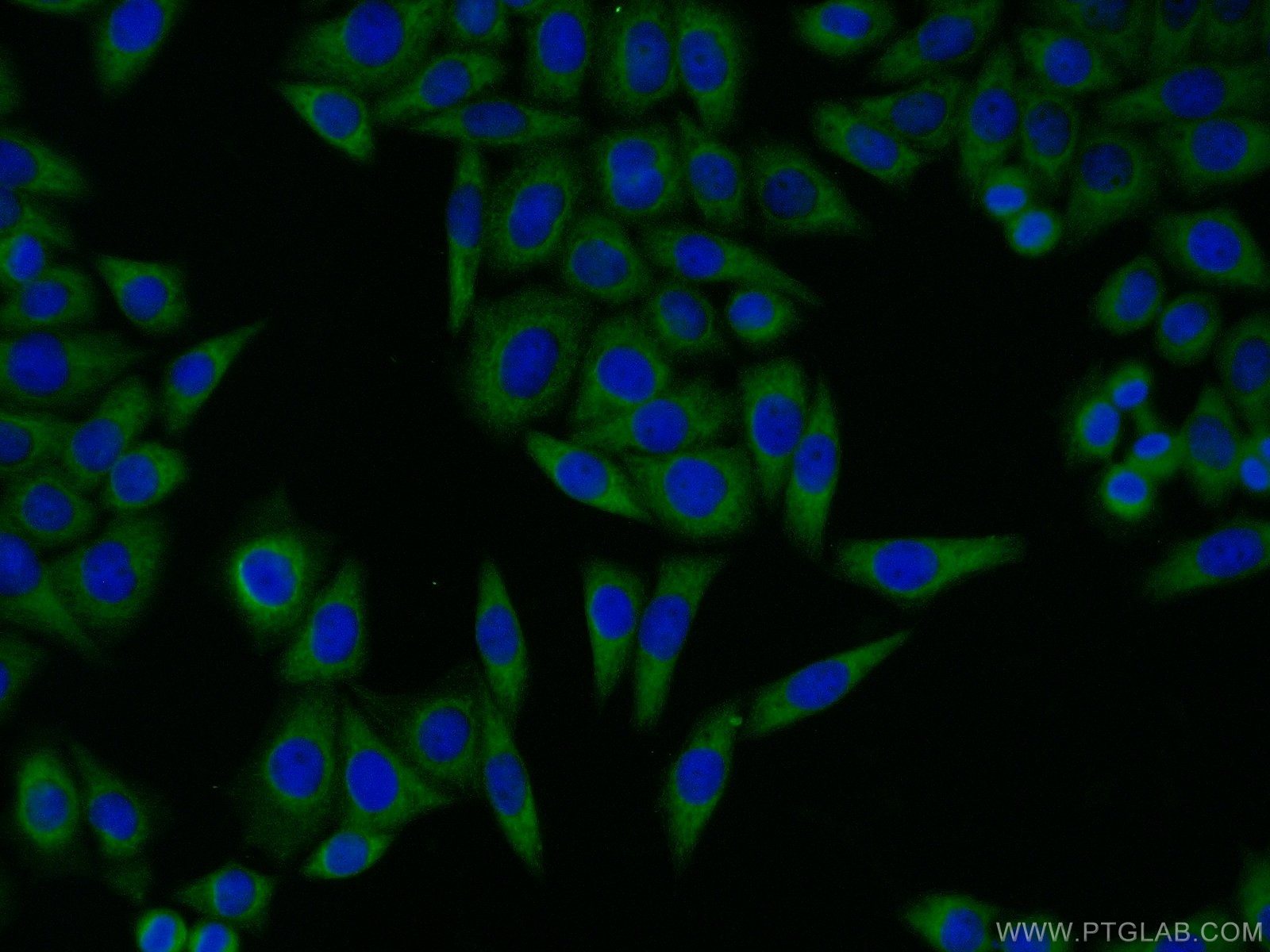 Immunofluorescence (IF) / fluorescent staining of HeLa cells using GBF1 Polyclonal antibody (25183-1-AP)