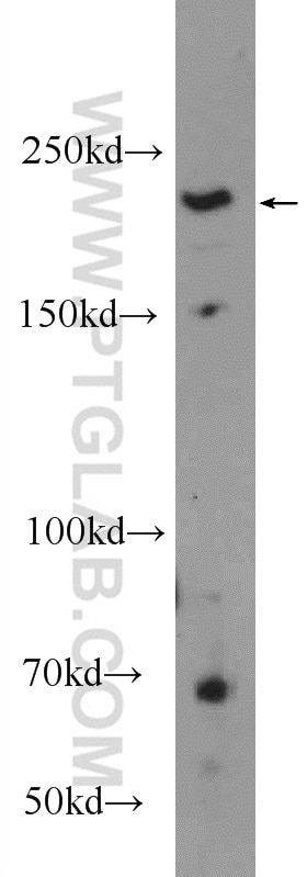 Western Blot (WB) analysis of HeLa cells using GBF1 Polyclonal antibody (25183-1-AP)