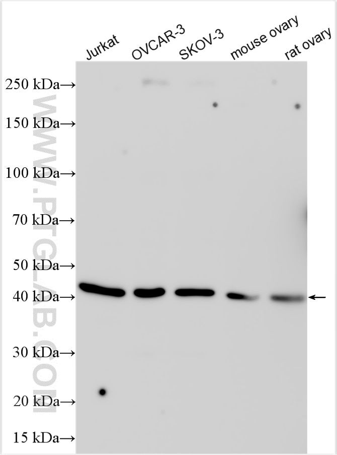 WB analysis using 32983-1-AP (same clone as 32983-1-PBS) Western Blot (WB) analysis of various lysates using GBGT1 Polyclonal antibody (32983-1-AP)