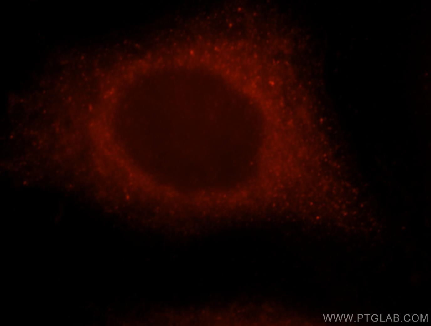 Immunofluorescence (IF) / fluorescent staining of MCF-7 cells using GBP1 Polyclonal antibody (15303-1-AP)
