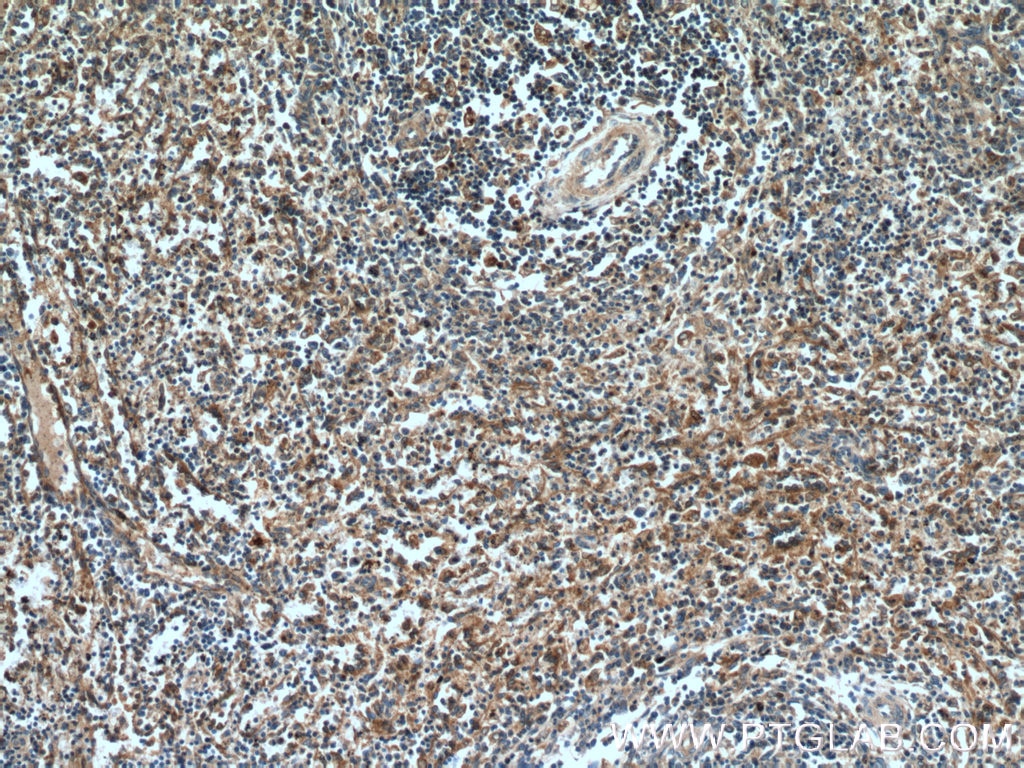 Immunohistochemistry (IHC) staining of human spleen tissue using GBP1 Polyclonal antibody (15303-1-AP)