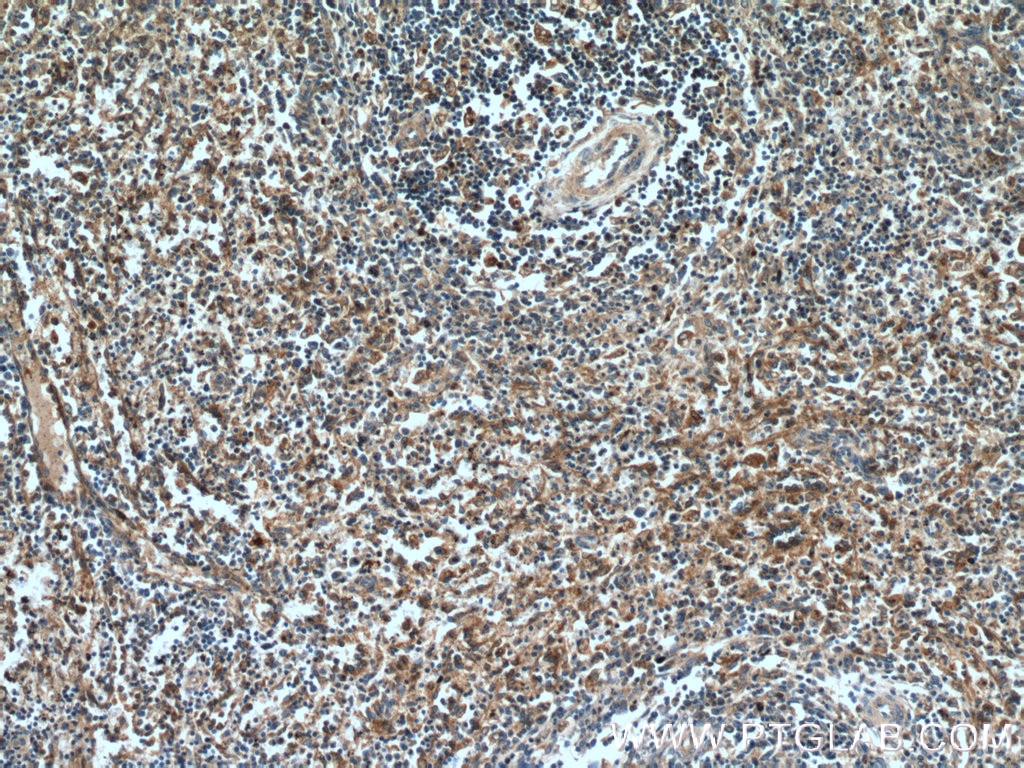 IHC staining of human spleen using 15303-1-AP