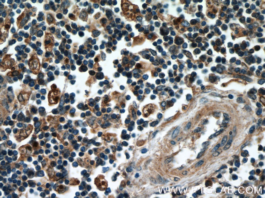 Immunohistochemistry (IHC) staining of human spleen tissue using GBP1 Polyclonal antibody (15303-1-AP)