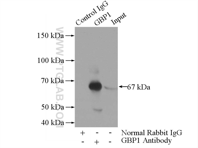 Immunoprecipitation (IP) experiment of human placenta tissue using GBP1 Polyclonal antibody (15303-1-AP)