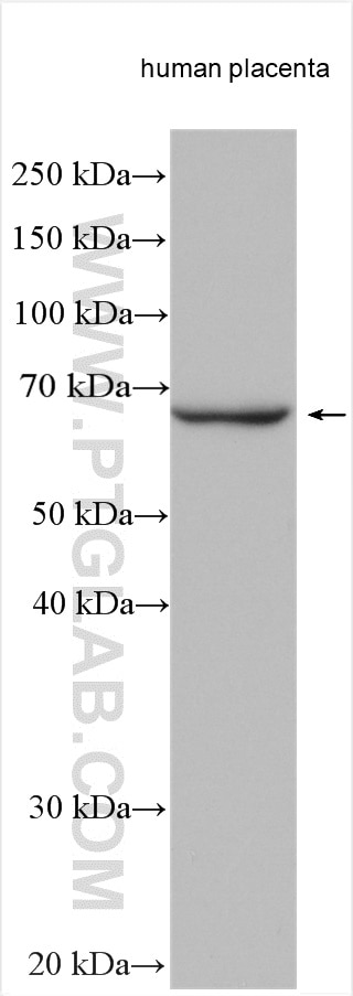 Western Blot (WB) analysis of various lysates using GBP1 Polyclonal antibody (15303-1-AP)