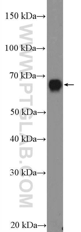 Western Blot (WB) analysis of HUVEC cells using GBP1 Polyclonal antibody (15303-1-AP)