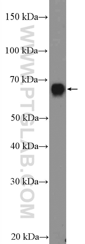 WB analysis of HUVEC using 15303-1-AP