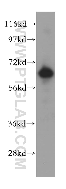 Western Blot (WB) analysis of human brain tissue using GBP1 Polyclonal antibody (15303-1-AP)