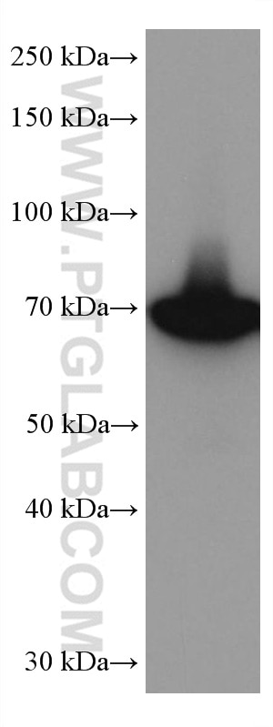 Western Blot (WB) analysis of HeLa cells using GBP1 Monoclonal antibody (67161-1-Ig)