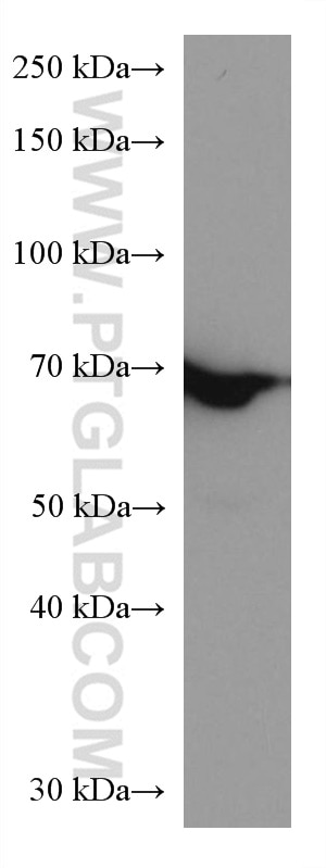 Western Blot (WB) analysis of HUVEC cells using GBP1 Monoclonal antibody (67161-1-Ig)