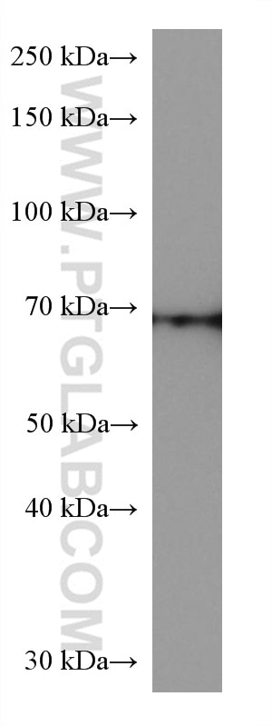 Western Blot (WB) analysis of HEK-293 cells using GBP1 Monoclonal antibody (67161-1-Ig)